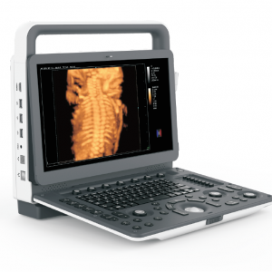Ecografo portatil M30 ZONCARE